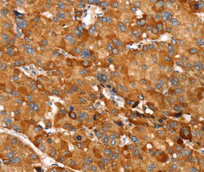 RNF14 Antibody in Immunohistochemistry (Paraffin) (IHC (P))