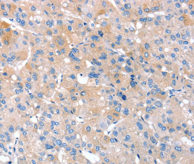 RNF214 Antibody in Immunohistochemistry (Paraffin) (IHC (P))