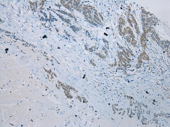 SERPINB11 Antibody in Immunohistochemistry (Paraffin) (IHC (P))