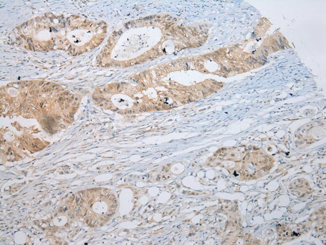 SSBP4 Antibody in Immunohistochemistry (Paraffin) (IHC (P))