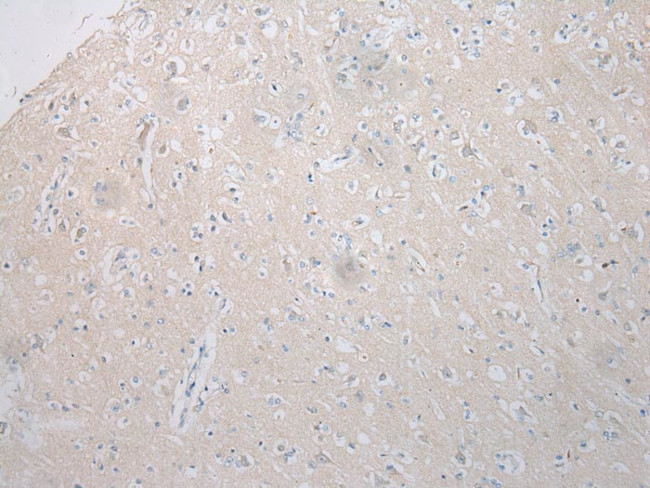 STARD8 Antibody in Immunohistochemistry (Paraffin) (IHC (P))