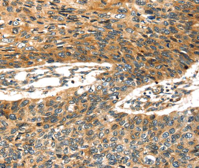 STX19 Antibody in Immunohistochemistry (Paraffin) (IHC (P))