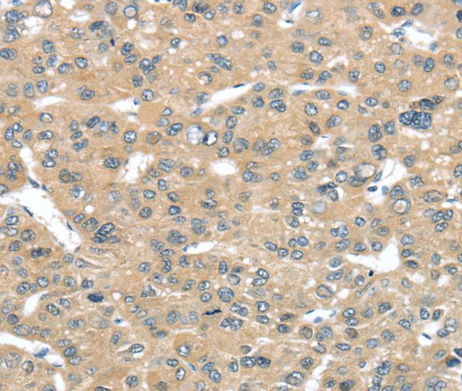 TUSC2 Antibody in Immunohistochemistry (Paraffin) (IHC (P))