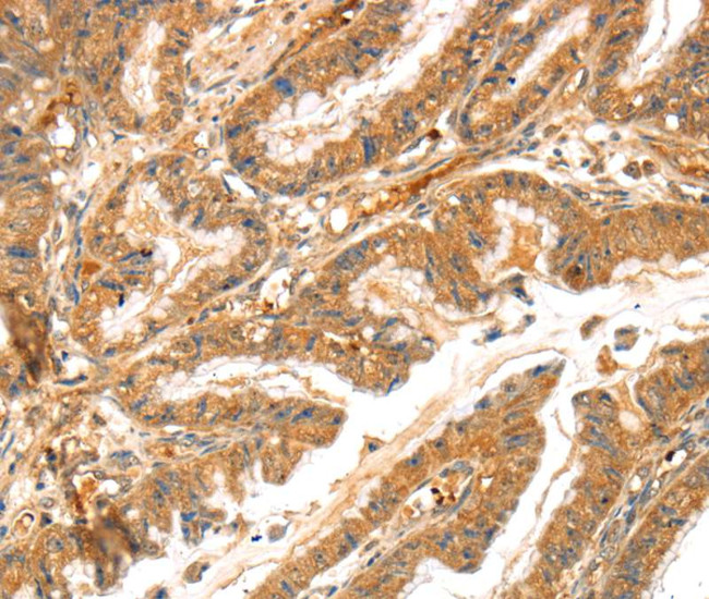 LPP Antibody in Immunohistochemistry (Paraffin) (IHC (P))