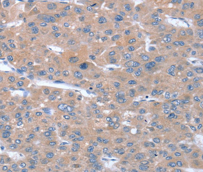 SULF1 Antibody in Immunohistochemistry (Paraffin) (IHC (P))
