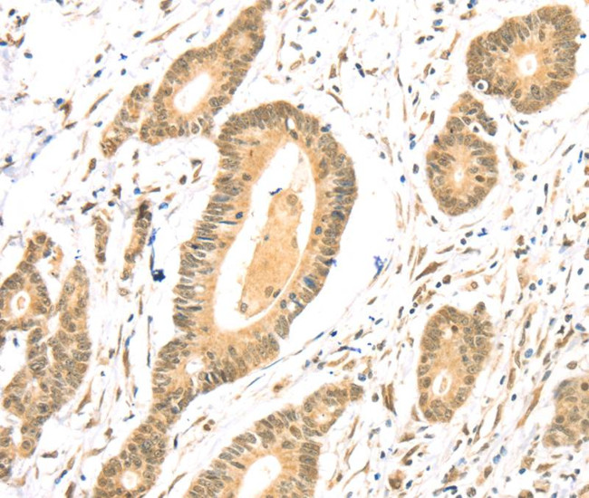 TSPAN13 Antibody in Immunohistochemistry (Paraffin) (IHC (P))