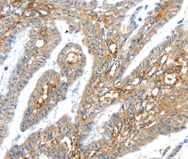 TRIM47 Antibody in Immunohistochemistry (Paraffin) (IHC (P))