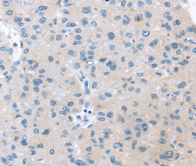 VPS4B Antibody in Immunohistochemistry (Paraffin) (IHC (P))