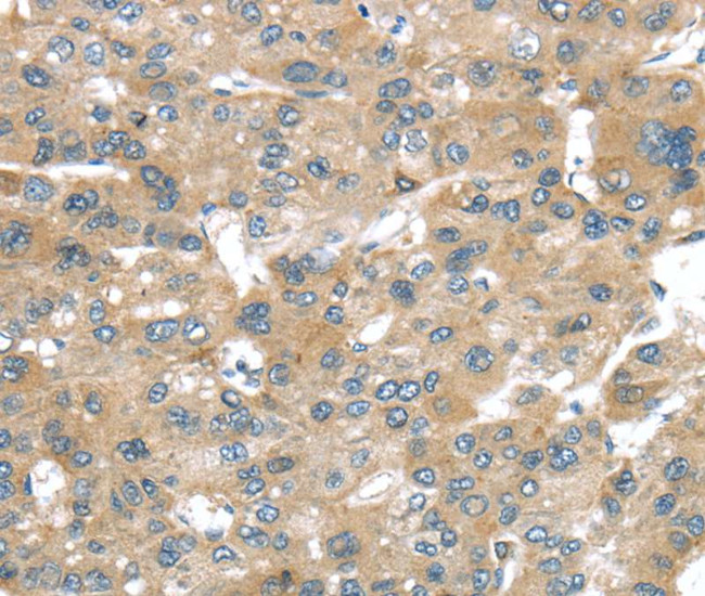 BRWD1 Antibody in Immunohistochemistry (Paraffin) (IHC (P))