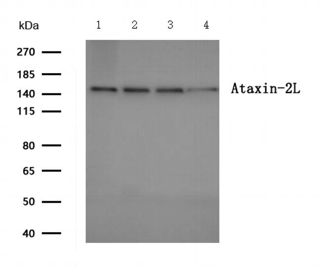 ATXN2L Antibody in Western Blot (WB)
