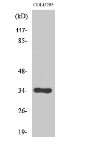 Cdc34 Antibody in Western Blot (WB)