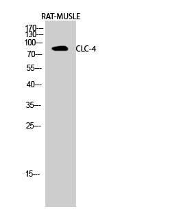 CLCN4 Antibody in Western Blot (WB)