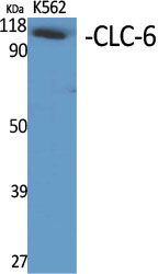 CLCN6 Antibody in Western Blot (WB)