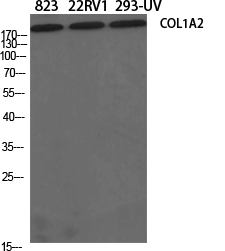 COL1A2 Antibody in Western Blot (WB)