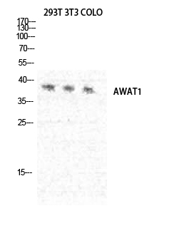 AWAT1 Antibody in Western Blot (WB)