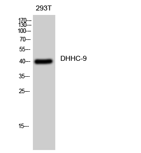 ZDHHC9 Antibody in Western Blot (WB)