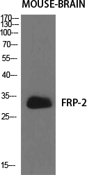 SFRP2 Antibody in Western Blot (WB)