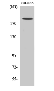 GCP6 Antibody in Western Blot (WB)
