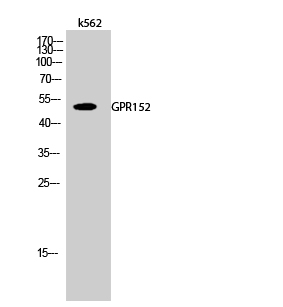 GPR152 Antibody in Western Blot (WB)