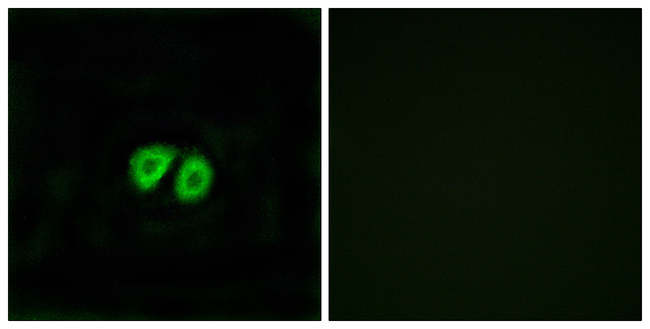 GPR56 Antibody in Immunocytochemistry (ICC/IF)