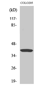 GNAT1 Antibody in Western Blot (WB)
