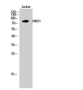 MYST2 Antibody in Western Blot (WB)