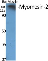 MYOM2 Antibody in Western Blot (WB)