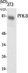 PFKL Antibody in Western Blot (WB)