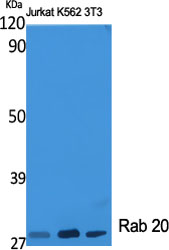 RAB20 Antibody in Western Blot (WB)