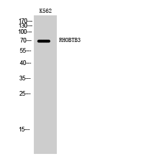 RhoBTB3 Antibody in Western Blot (WB)