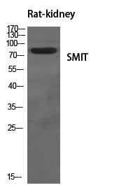 SLC5A3 Antibody in Western Blot (WB)