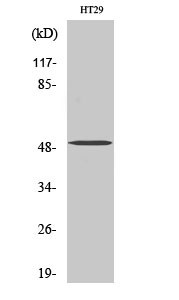SMYD2 Antibody in Western Blot (WB)