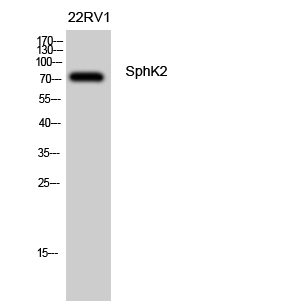 SPHK2 Antibody in Western Blot (WB)