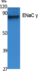 SCNN1G Antibody in Western Blot (WB)
