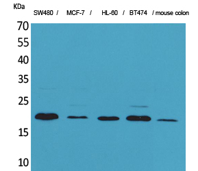 FGF20 Antibody in Western Blot (WB)