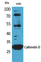 Calbindin D28K Antibody in Western Blot (WB)