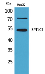 SPTLC1 Antibody in Western Blot (WB)