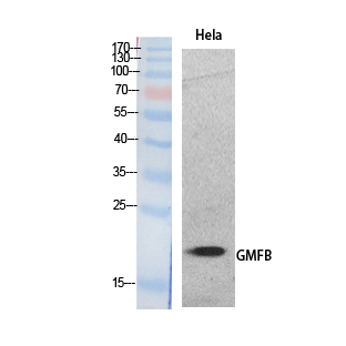 GMFB Antibody in Western Blot (WB)