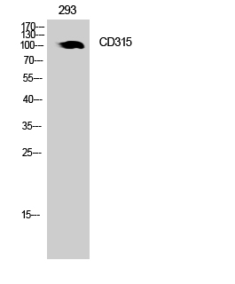 PTGFRN Antibody in Western Blot (WB)