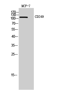 CD249 Antibody in Western Blot (WB)