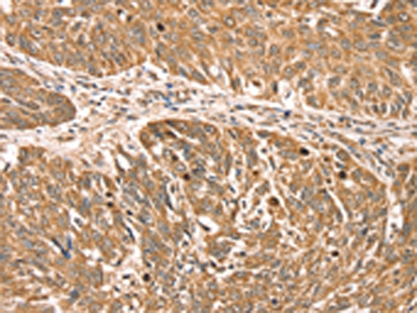 RPLP2 Antibody in Immunohistochemistry (Paraffin) (IHC (P))