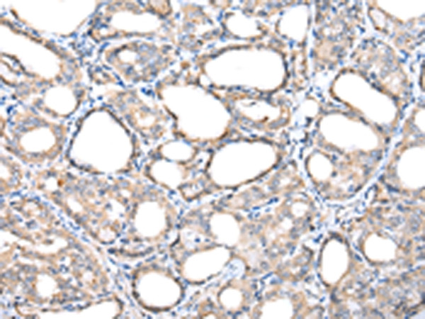 TIM17 Antibody in Immunohistochemistry (Paraffin) (IHC (P))