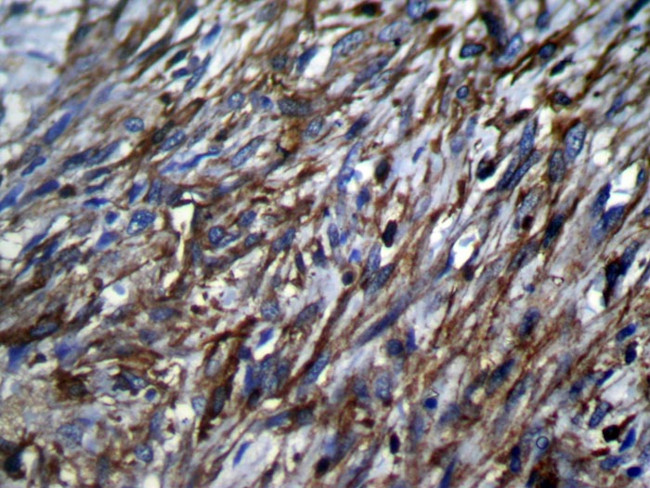 TSSC1 Antibody in Immunohistochemistry (Paraffin) (IHC (P))