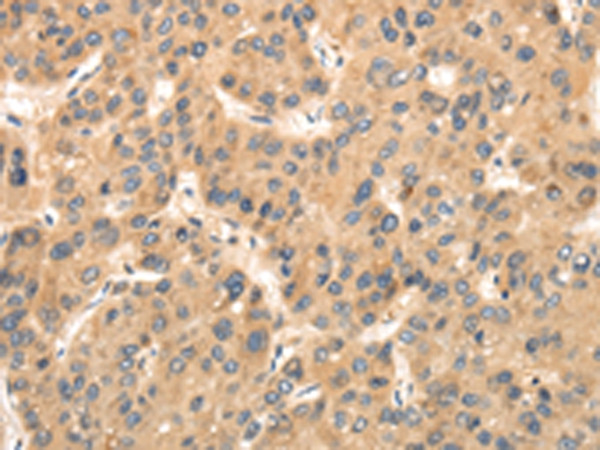 TTC23 Antibody in Immunohistochemistry (Paraffin) (IHC (P))