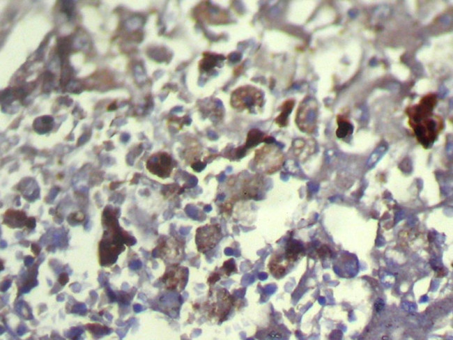 TXNDC11 Antibody in Immunohistochemistry (Paraffin) (IHC (P))