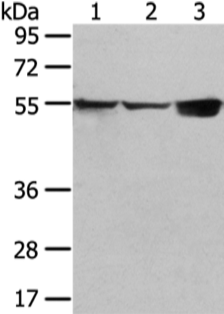 UGT1A10 Antibody in Western Blot (WB)