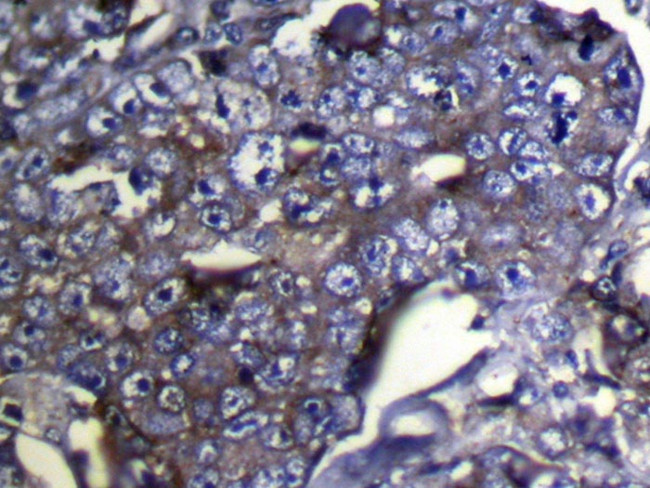 DUSP11 Antibody in Immunohistochemistry (Paraffin) (IHC (P))