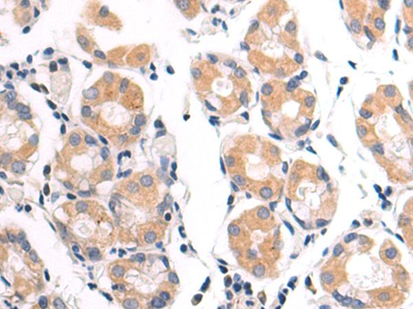 VDAC3 Antibody in Immunohistochemistry (Paraffin) (IHC (P))