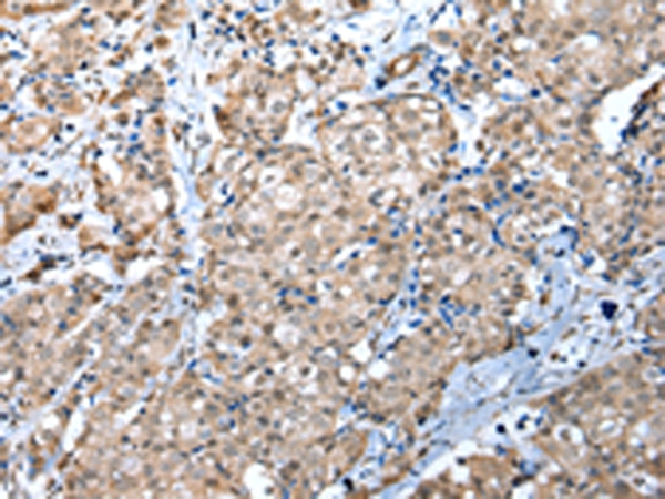WDR4 Antibody in Immunohistochemistry (Paraffin) (IHC (P))