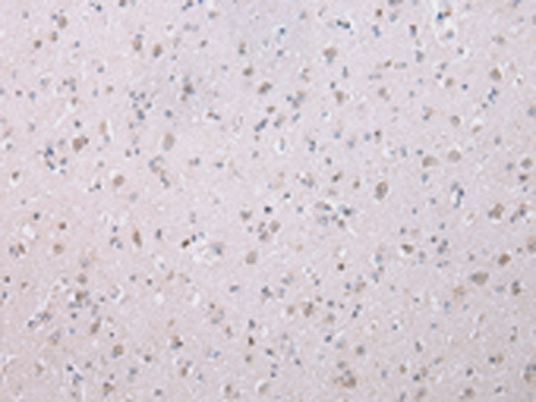 WISP3 Antibody in Immunohistochemistry (Paraffin) (IHC (P))
